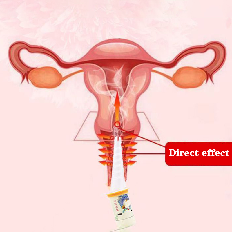 Women-Only Moxibustion Tool fo - Therapy Health And Wellness ulasan dan harga