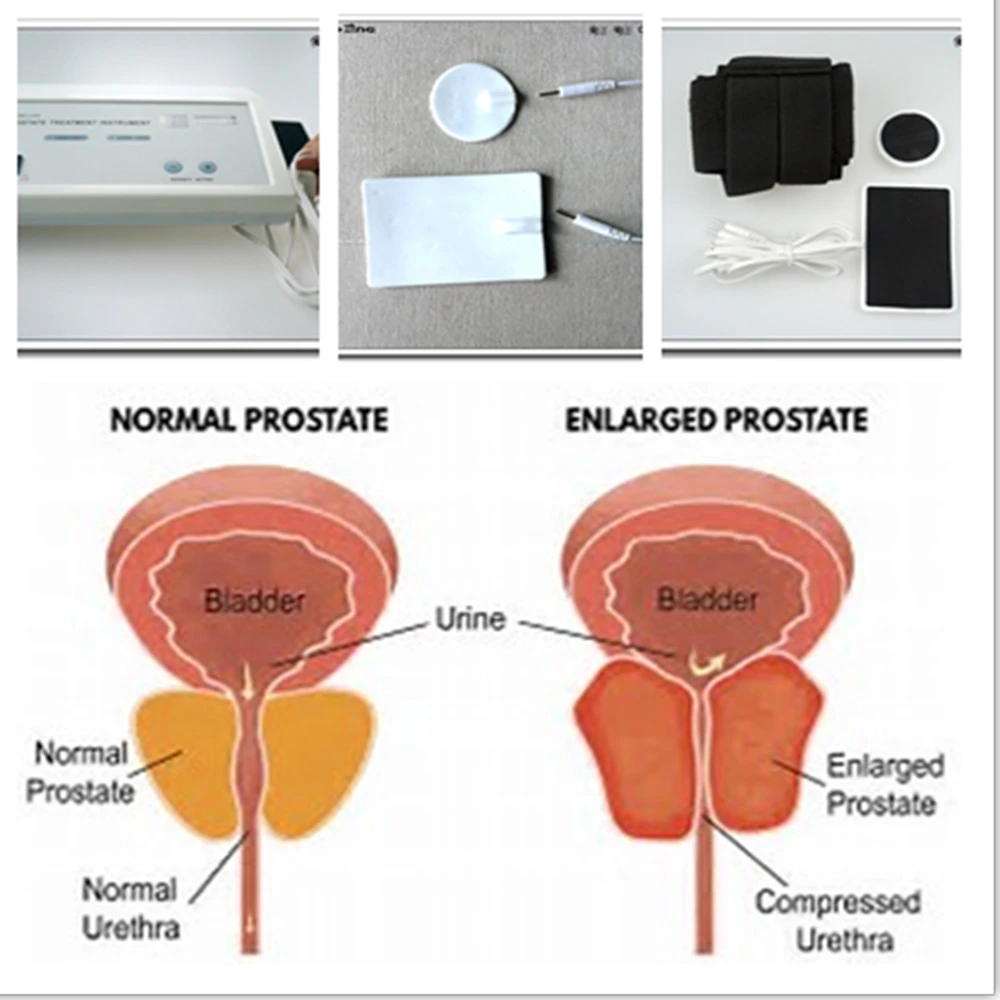 Powerful Prostate Massager Pul - Therapy Health And Wellness ulasan dan harga