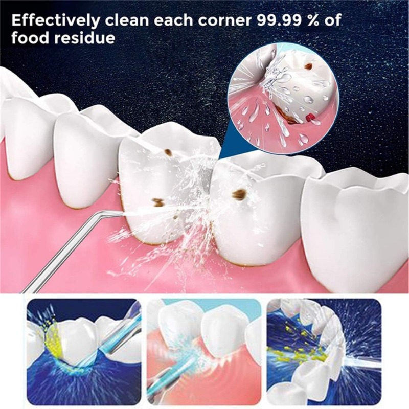 110ML/140ML Portable Hand-Powe - Oral Irrigator Flosser ulasan dan harga