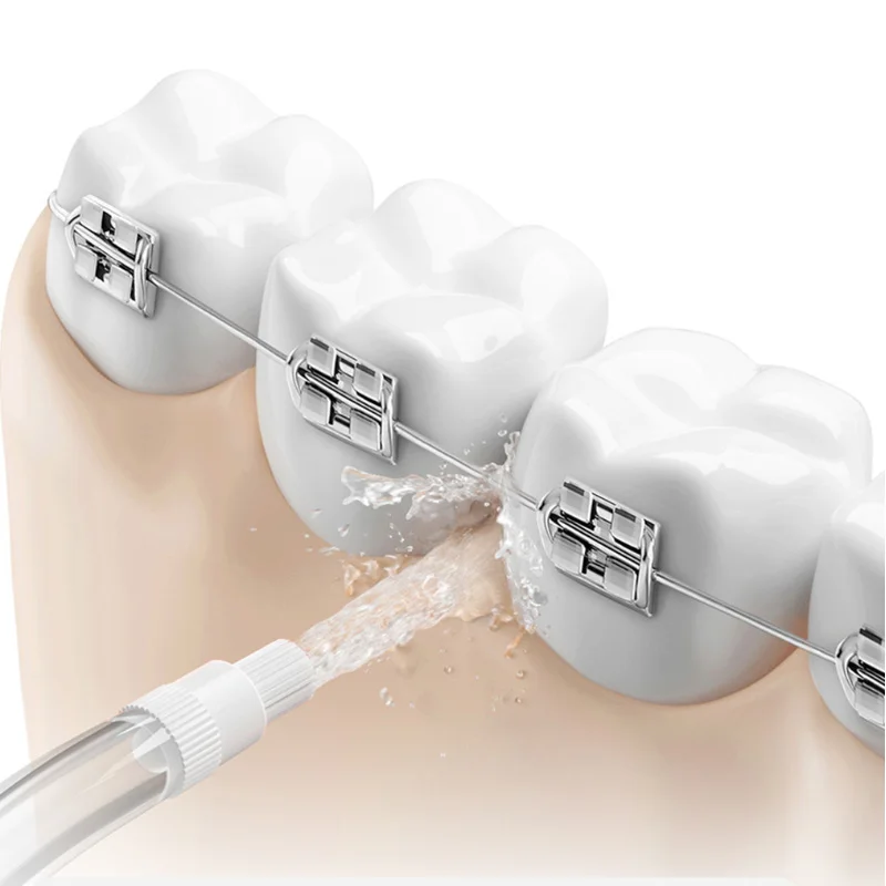 Original Nozzles for all Xiaom - Oral Irrigator Flosser ulasan dan harga